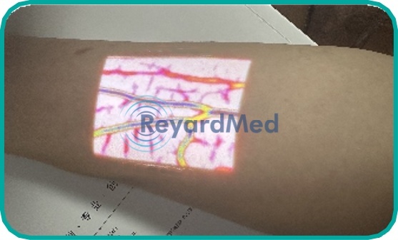 Digital Color Vein Finder System: V600