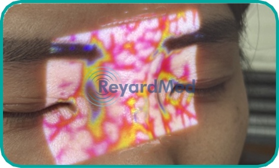 Digital Color Vein Finder System: V600