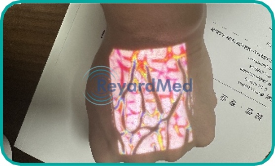 Digital Color Vein Finder System: V600