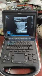 Used Like New SonoSite Edge Ultrasound Machine