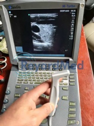 Used Like New SonoSite M-Turbo Ultrasound Machine