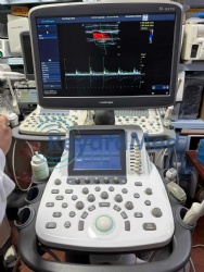Used Like New SonoScape S REVO Ultrasound Machine