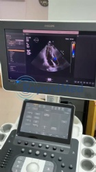 Used Like New Philips Affiniti 70 Ultrasound Machine