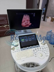 Used Like New GE Voluson E8 Ultrasound Machine