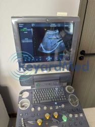 Used Like New GE Voluson P8 Ultrasound Machine