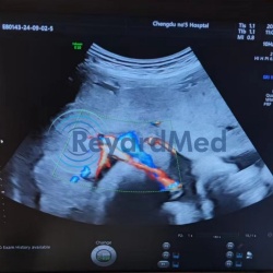 New GE C1-6-D Convex Ultrasound Probe