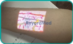 Digital Color Vein Finder System: V600