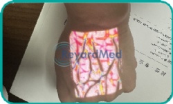 Digital Color Vein Finder System: V600