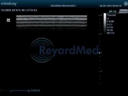 MINDRAY 75L38EB Linear Transducer Ultrasound Probe Repair Service